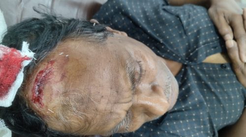 ‎নবীগঞ্জে চাঁদা না দেওয়ায় বিবিয়ানায় পাওয়ার প্লান্ট কর্মচারীর ওপর সন্ত্রাসী হামলার অভিযোগ