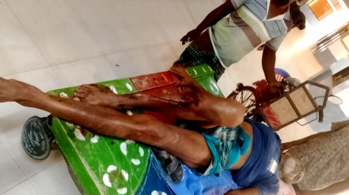 শৈলকুপায় জমাজমি বিরোধে সংঘর্ষ; কুপিয়ে জখম ২