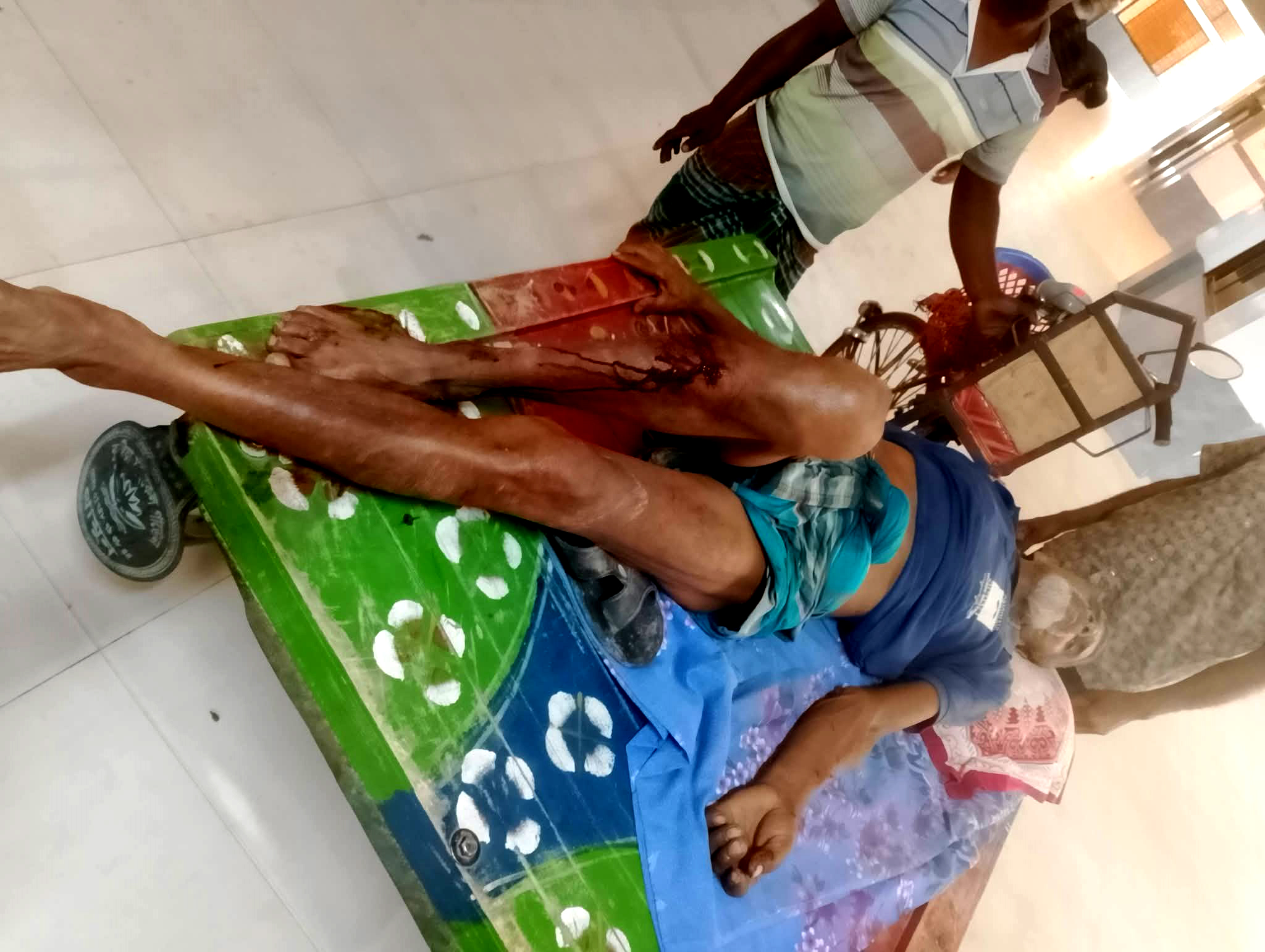 শৈলকুপায় জমাজমি বিরোধে সংঘর্ষ; কুপিয়ে জখম ২