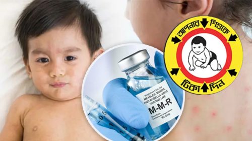 ৩০ উপজেলায় দেওয়া হচ্ছে হামের বিশেষ টিকা